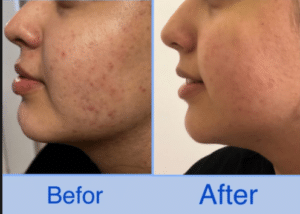 نمونه پاکسازی پوست کلینیک زیبایی صدف