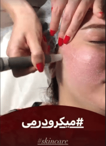 نمونه پاکسازی پوست کلینیک زیبایی صدف