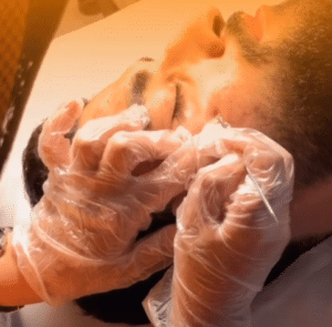 نمونه پاکسازی پوست کلینیک زیبایی صدف