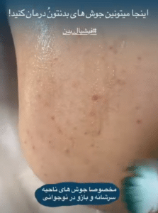 نمونه پاکسازی پوست کلینیک زیبایی صدف