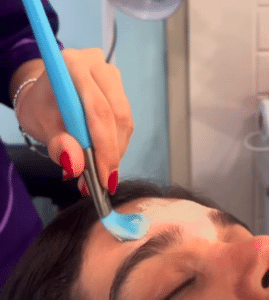 نمونه پاکسازی پوست کلینیک زیبایی صدف