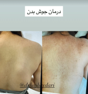 نمونه پاکسازی پوست کلینیک زیبایی صدف