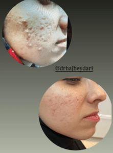 نمونه پاکسازی پوست کلینیک زیبایی صدف