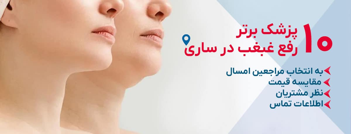 بهترین دکتر رفع غبغب در ساری