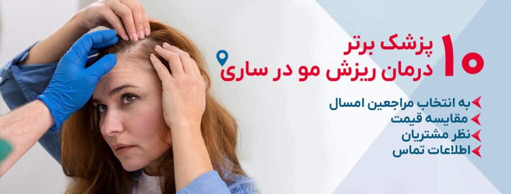 بهترین دکتر درمان ریزش مو در ساری