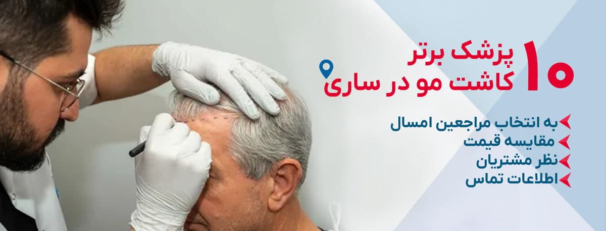 بهترین دکتر کاشت مو در ساری