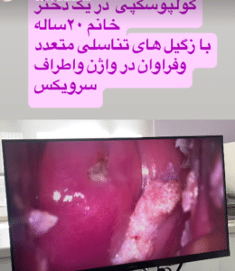 نمونه درمان رگیل تناسلی دکتر فرح ابطحی