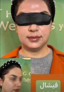 نمونه پاکسازی پوست مرکز زیبایی نیلوفر