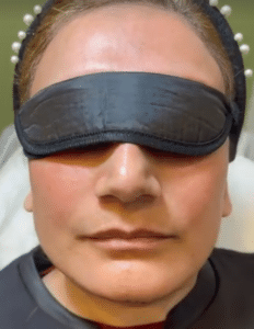 نمونه پاکسازی پوست مرکز زیبایی نیلوفر