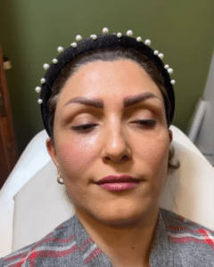 نمونه پاکسازی پوست مرکز زیبایی نیلوفر