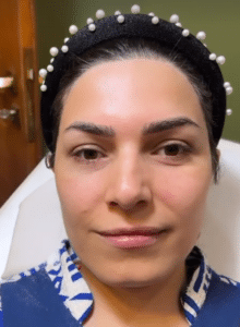 نمونه پاکسازی پوست مرکز زیبایی نیلوفر