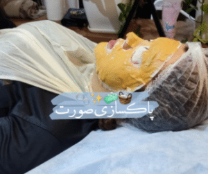 نمونه پاکسازی پوست کلینیک زیبایی دانژه