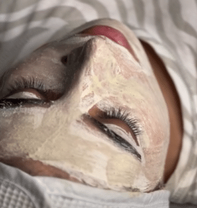 نمونه پاکسازی پوست کلینیک زیبایی فلورا