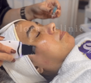 نمونه پاکسازی پوست کلینیک زیبایی فلورا
