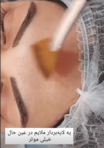 نمونه پاکسازی پوست کلینیک زیبایی رزگلد