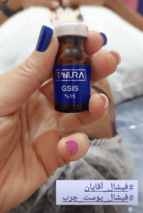 نمونه پاکسازی پوست کلینیک زیبایی رزگلد