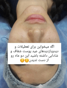 نمونه پاکسازی پوست کلینیک زیبایی رزگلد