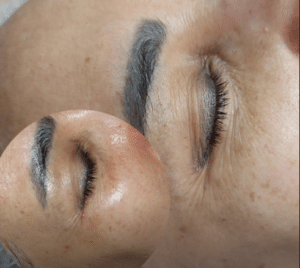 نمونه پاکسازی پوست کلینیک زیبایی رزگلد