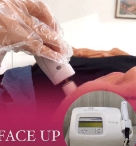 نمونه درمان جای لک و جوش دکتر زهره حاج حیدری (کلینیک زیبایی صدف)