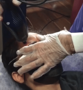 نمونه درمان جای لک و جوش دکتر صادق هاشمی نسب