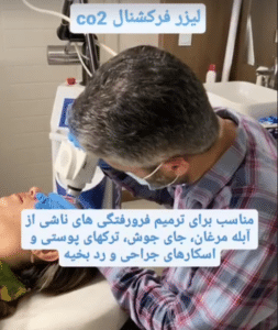 نمونه درمان جای لک و جوش دکتر صادق هاشمی نسب