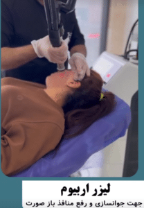 نمونه درمان جای لک و جوش دکتر قاسم رحمت پور رکنی (کلینیک زیبایی باران)