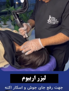 نمونه درمان جای لک و جوش دکتر قاسم رحمت پور رکنی (کلینیک زیبایی باران)