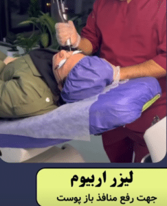 نمونه درمان جای لک و جوش دکتر قاسم رحمت پور رکنی (کلینیک زیبایی باران)