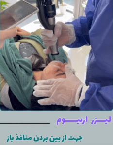 نمونه درمان جای لک و جوش دکتر قاسم رحمت پور رکنی (کلینیک زیبایی باران)