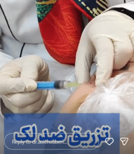 نمونه درمان جای لک و جوش دکتر آسیه صابری