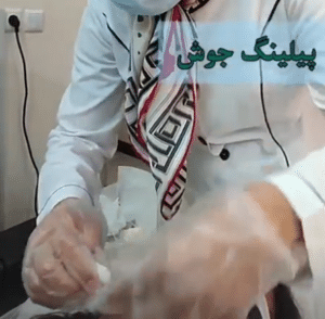 نمونه درمان جای لک و جوش دکتر آسیه صابری