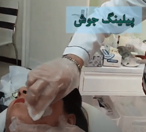 نمونه درمان جای لک و جوش دکتر آسیه صابری