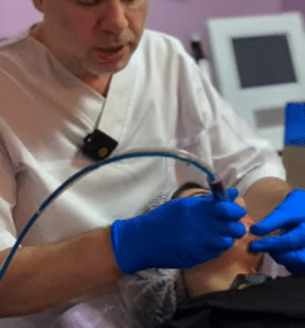 نمونه درمان جای لک و جوش دکتر حسین خسروی