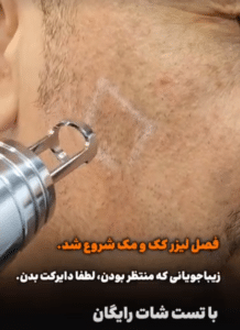 نمونه درمان لک و جوش کلینیک زیبایی الگانت
