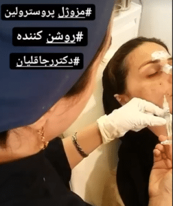 نمونه درمان جای لک و جوش دکتر رجا قلیان