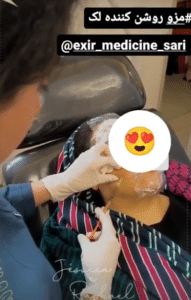 نمونه درمان جای لک و جوش دکتر رجا قلیان