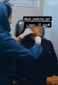 نمونه درمان جای لک و جوش دکتر رجا قلیان