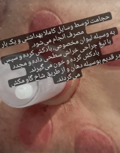 نمونه ماساژ مرکز سرو