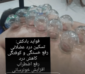 نمونه ماساژ مرکز سرو