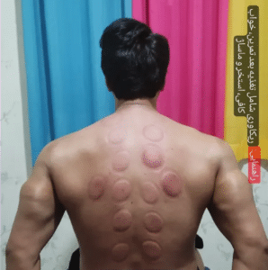 نمونه ماساژ مرکز حیاتی