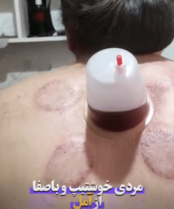 نمونه ماساژ مرکز حیاتی