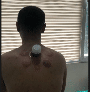 نمونه ماساژ مرکز حیاتی