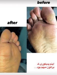 نمونه ماساژ مرکز حیاتی