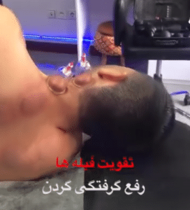 نمونه ماساژ مرکز حیاتی