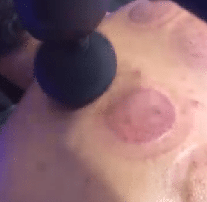 نمونه ماساژ مرکز حیاتی