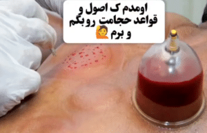 نمونه ماساژ مرکز حیاتی