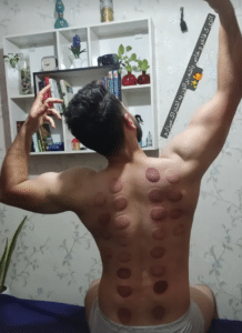 نمونه ماساژ مرکز حیاتی