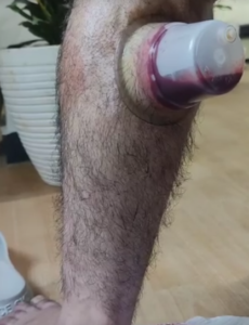 نمونه ماساژ مرکز حس تازه