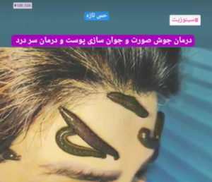 نمونه ماساژ مرکز حس تازه