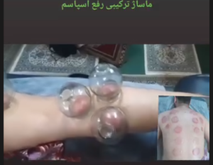 نمونه ماساژ مرکز ماساژ احمدی